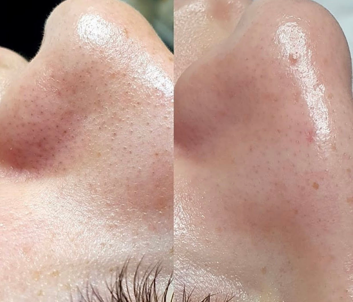 BloomLift™ Instant Cream