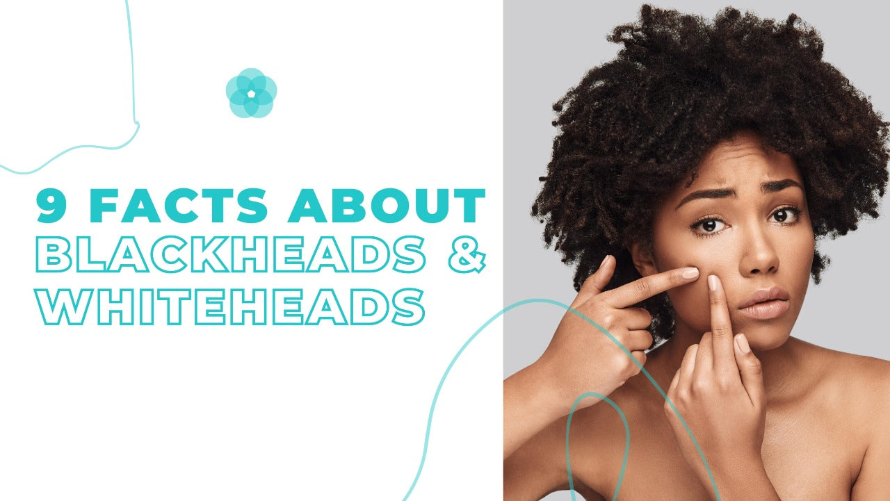 9 Fast Facts about Blackheads & Whiteheads